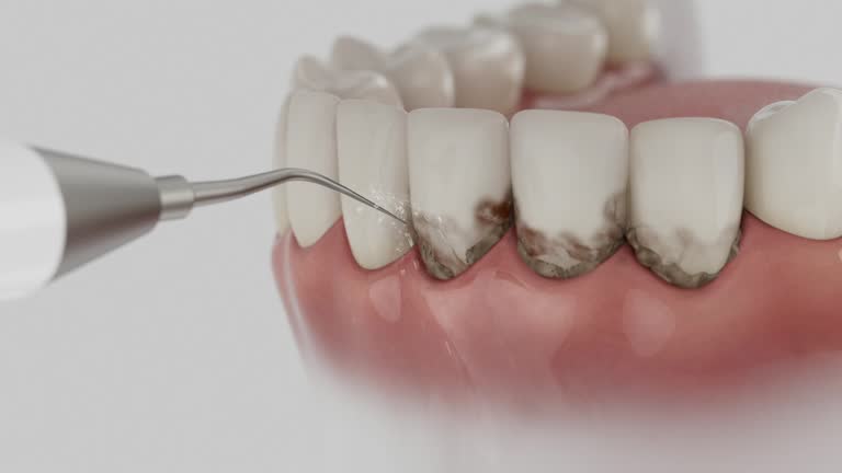 Reliable Dental Implants contractor in Forsyth, IL by Smile Center Dentistry
